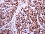 MAFF Antibody in Immunohistochemistry (Paraffin) (IHC (P))