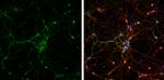 VAMP2 Antibody in Immunocytochemistry (ICC/IF)