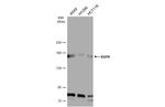 EGFR Antibody in Western Blot (WB)