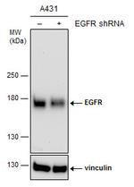 EGFR Antibody in Western Blot (WB)