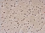 SLUG Antibody in Immunohistochemistry (Paraffin) (IHC (P))