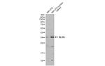 SLUG Antibody in Western Blot (WB)