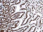 Histone H3 Antibody in Immunohistochemistry (Paraffin) (IHC (P))