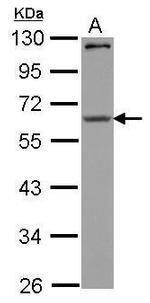 CPEB1 Antibody in Western Blot (WB)