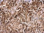 TET2 Antibody in Immunohistochemistry (Paraffin) (IHC (P))