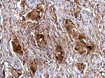 SNAIL Antibody in Immunohistochemistry (Paraffin) (IHC (P))