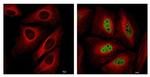 HIF1A Antibody in Immunocytochemistry (ICC/IF)