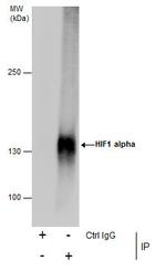 HIF1A Antibody in Immunoprecipitation (IP)