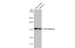 N-cadherin Antibody in Western Blot (WB)