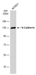 N-cadherin Antibody in Western Blot (WB)