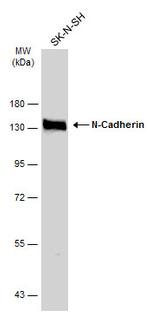 N-cadherin Antibody in Western Blot (WB)