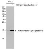 Phospho-Histone H3 (Ser10) Antibody in Western Blot (WB)