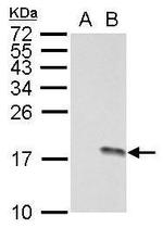 Phospho-Histone H3 (Ser10) Antibody in Western Blot (WB)