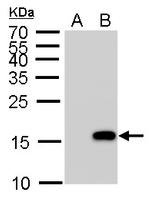 Phospho-Histone H3 (Ser10) Antibody in Western Blot (WB)