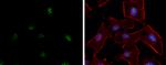 ATR Antibody in Immunocytochemistry (ICC/IF)