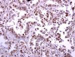 ATR Antibody in Immunohistochemistry (Paraffin) (IHC (P))