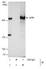 ATR Antibody in Immunoprecipitation (IP)