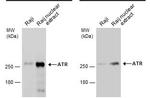 ATR Antibody in Western Blot (WB)