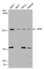 ATR Antibody in Western Blot (WB)