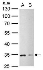 Phospho-CDK1 (Tyr15) Antibody in Western Blot (WB)