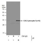 Phospho-CDK1 (Tyr15) Antibody in Immunoprecipitation (IP)