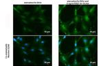 Phospho-AKT1 (Ser473) Antibody in Immunocytochemistry (ICC/IF)