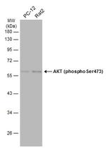 Phospho-AKT1 (Ser473) Antibody in Western Blot (WB)