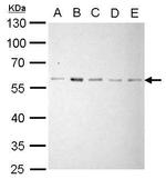 AKT2 Antibody in Western Blot (WB)