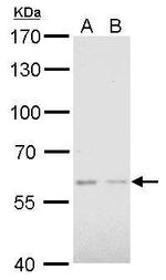 AKT2 Antibody in Western Blot (WB)