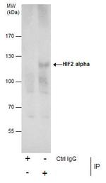 HIF-2 alpha Antibody in Immunoprecipitation (IP)