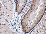 HIF-1 beta Antibody in Immunohistochemistry (Paraffin) (IHC (P))