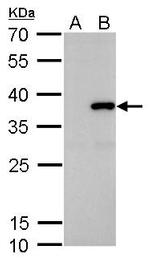 SLUG Antibody in Western Blot (WB)