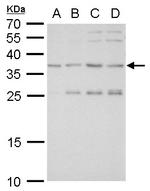 SLUG Antibody in Western Blot (WB)