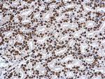 H3K27ac Antibody in Immunohistochemistry (Paraffin) (IHC (P))