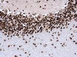 H3K4me3 Antibody in Immunohistochemistry (Paraffin) (IHC (P))