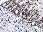 H4K20me3 Antibody in Immunohistochemistry (Paraffin) (IHC (P))