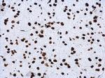 H4K20me3 Antibody in Immunohistochemistry (Paraffin) (IHC (P))