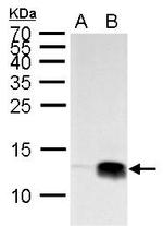 H4K20me3 Antibody in Western Blot (WB)