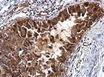 IGFBP2 Antibody in Immunohistochemistry (Paraffin) (IHC (P))