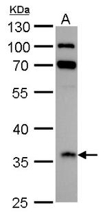 IGFBP2 Antibody in Western Blot (WB)