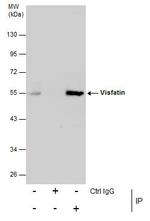 NAMPT Antibody in Immunoprecipitation (IP)