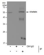 NAMPT Antibody in Immunoprecipitation (IP)