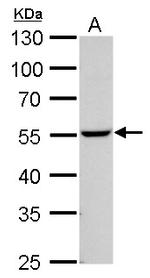 NAMPT Antibody in Western Blot (WB)