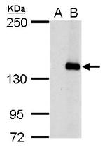 JARID2 Antibody in Western Blot (WB)