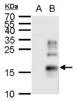 TGF alpha Antibody in Western Blot (WB)