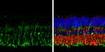 DLX2 Antibody in Immunohistochemistry (Paraffin) (IHC (P))