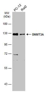 DNMT3A Antibody in Western Blot (WB)