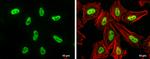 DNMT3B Antibody in Immunocytochemistry (ICC/IF)