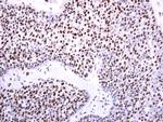 DNMT3B Antibody in Immunohistochemistry (Paraffin) (IHC (P))