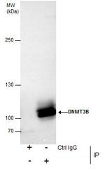 DNMT3B Antibody in Immunoprecipitation (IP)